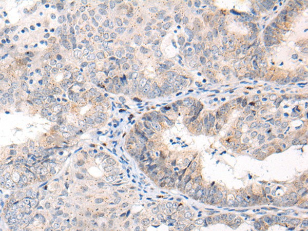 ANAPC15 Polyclonal Antibody (E-AB-19631)