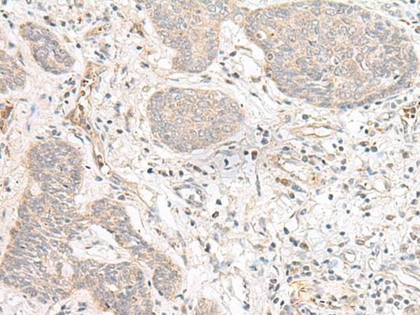 FBXW8 Polyclonal Antibody (E-AB-19858)