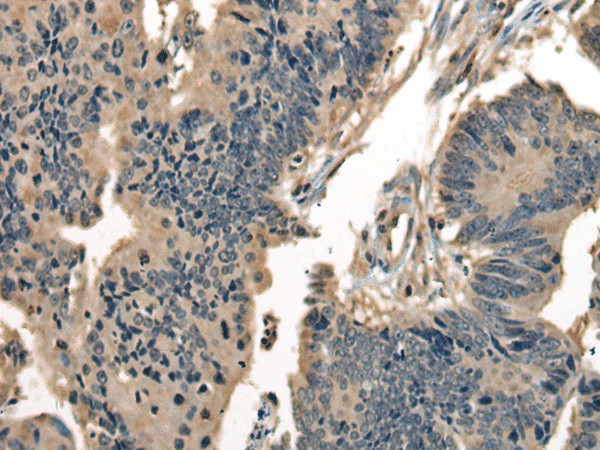 DNAJC2 Polyclonal Antibody (E-AB-17815)