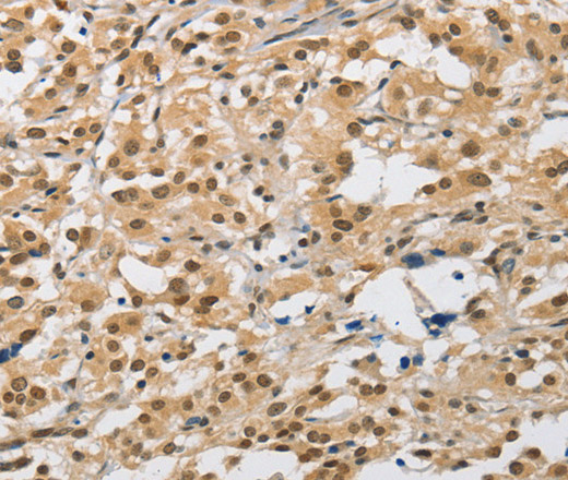 AMZ2 Polyclonal Antibody (E-AB-10824)
