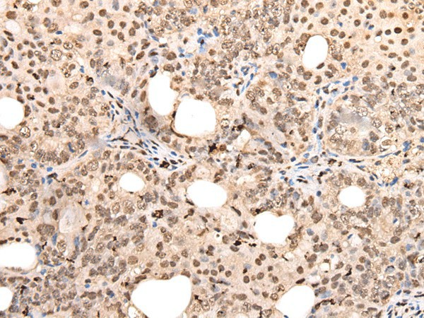 ZSCAN12 Polyclonal Antibody (E-AB-52397)