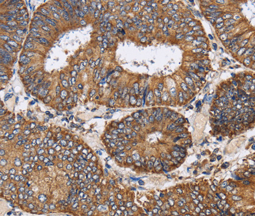 PDGFC Polyclonal Antibody (E-AB-13501)