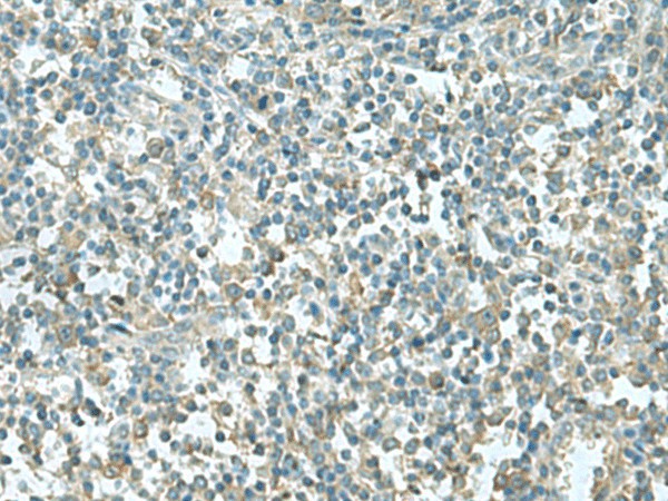 CCT5 Polyclonal Antibody (E-AB-19070)