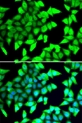 HDAC5 Polyclonal Antibody (E-AB-61573)