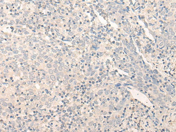 RADIL Polyclonal Antibody (E-AB-18694)