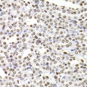 SOX5 Polyclonal Antibody (E-AB-61448)
