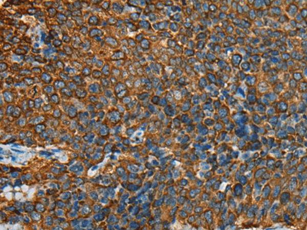 YBX1 Polyclonal Antibody (E-AB-53542)