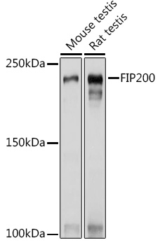 FIP200 Polyclonal Antibody (E-AB-90925)