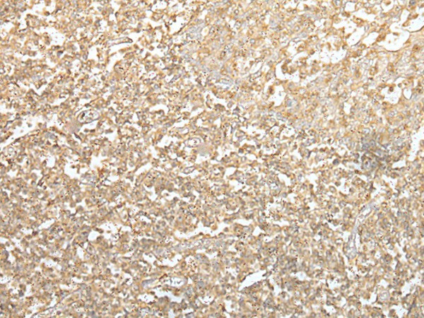 SPIC Polyclonal Antibody (E-AB-18438)