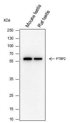 Recombinant PTBP2 Monoclonal Antibody (AN301639L)