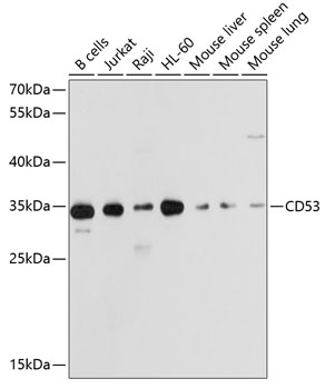 CD53 Polyclonal Antibody (E-AB-62659)
