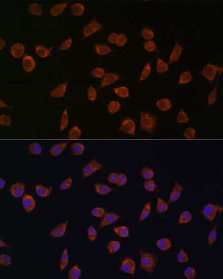 ACSS1 Polyclonal Antibody (E-AB-66383)