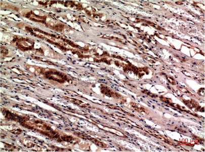 CST3 Monoclonal Antibody (E-AB-22218)