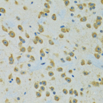 RPS7 Polyclonal Antibody (E-AB-61330)