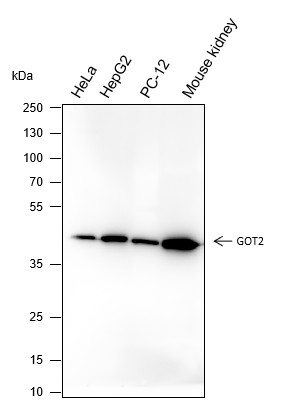 Recombinant GOT2 Monoclonal Antibody (AN301538L)