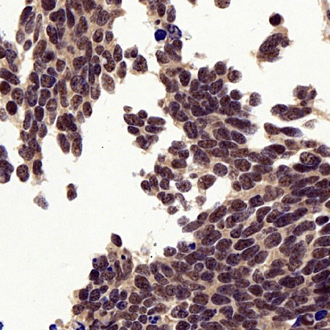 P38 Polyclonal Antibody (E-AB-70001)