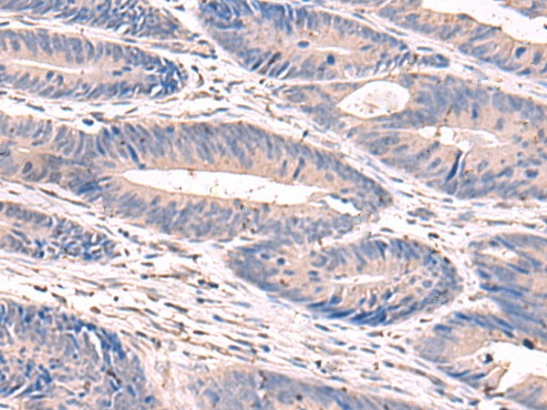 GKAP1 Polyclonal Antibody (E-AB-52731)