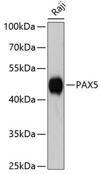PAX5 Polyclonal Antibody (E-AB-65425)