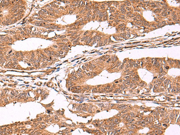 IST1 Polyclonal Antibody (E-AB-52046)