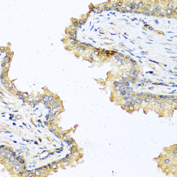 DEFB121 Polyclonal Antibody (E-AB-60251)