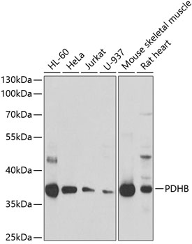 PDHB Polyclonal Antibody (E-AB-61420)