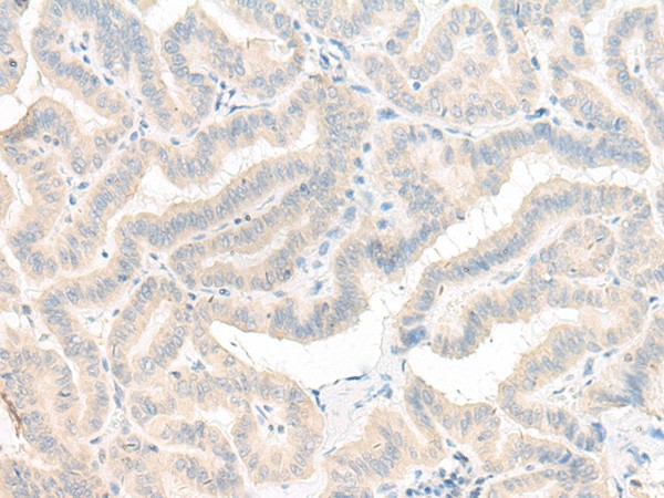 AOAH Polyclonal Antibody (E-AB-52653)