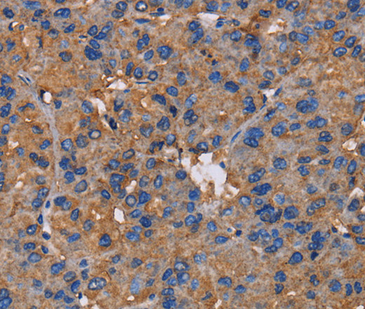 NCSTN Polyclonal Antibody (E-AB-15254)