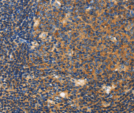 CERK Polyclonal Antibody (E-AB-14742)