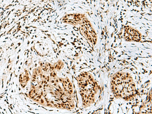 RBM10 Polyclonal Antibody (E-AB-52781)