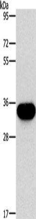 HOXB13 Polyclonal Antibody (E-AB-14131)