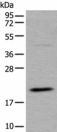 UFC1 Polyclonal Antibody (E-AB-52438)