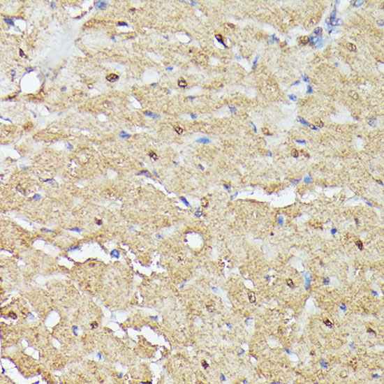 TRIP4 Polyclonal Antibody (E-AB-65278)