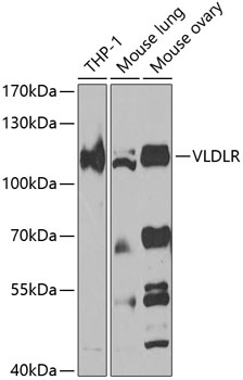 VLDLR Polyclonal Antibody (E-AB-92767)