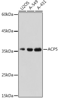 ACP5 Polyclonal Antibody (E-AB-68350)