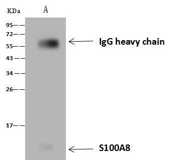 Recombinant S100A8 Monoclonal Antibody (AN300036P)