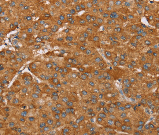 PAGE5 Polyclonal Antibody (E-AB-11466)