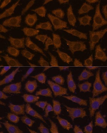 MTMR4 Polyclonal Antibody (E-AB-65276)