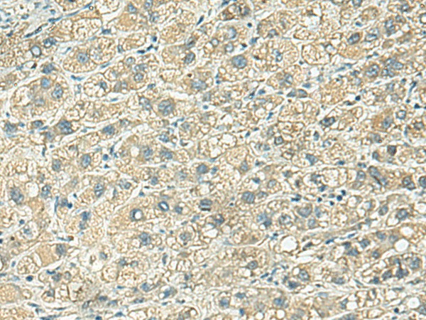 KLC2 Polyclonal Antibody (E-AB-52993)