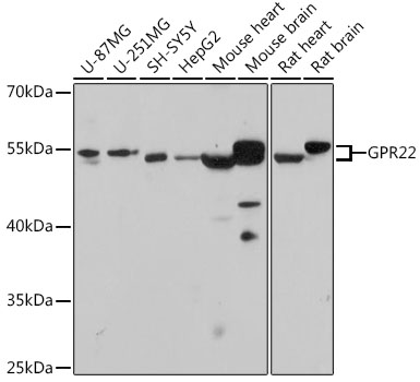 GPR22 Polyclonal Antibody (E-AB-67340)