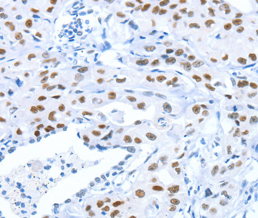 ARID1A Polyclonal Antibody (E-AB-12984)
