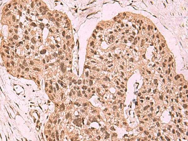 SETDB1 Polyclonal Antibody (E-AB-52933)