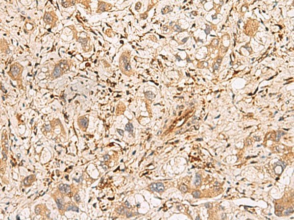 PLCB2 Polyclonal Antibody (E-AB-19161)