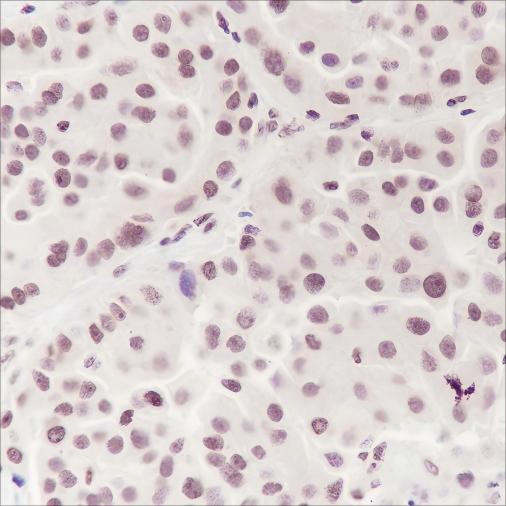 Recombinant Ataxin-3 Monoclonal Antibody (AN301440L)