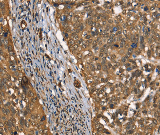 CSTB Polyclonal Antibody (E-AB-13179)
