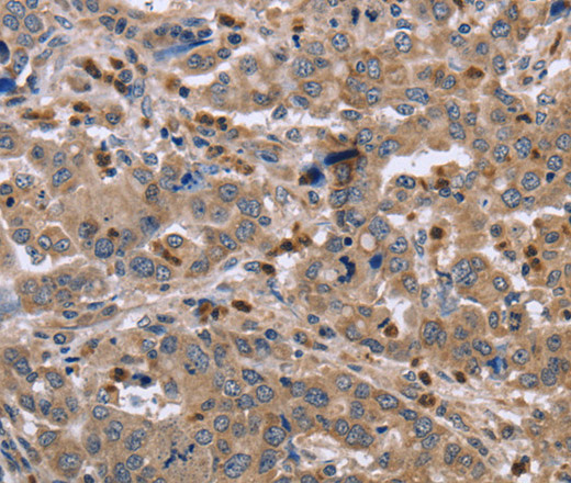 EDA Polyclonal Antibody (E-AB-11176)