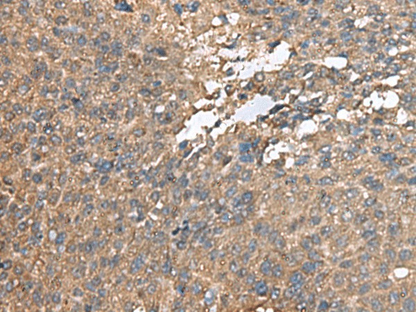 AHNAK Polyclonal Antibody (E-AB-53045)