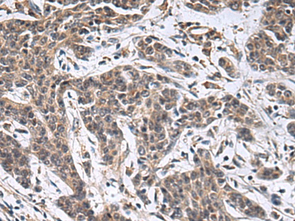 MBL2 Polyclonal Antibody (E-AB-19517)
