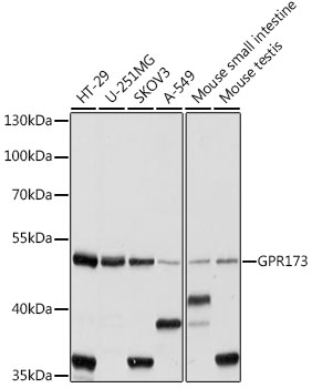 GPR173 Polyclonal Antibody (E-AB-90993)