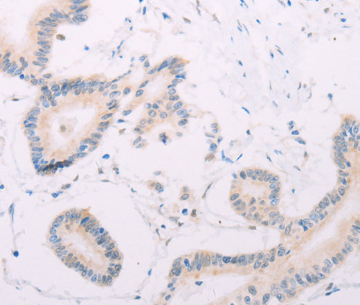 MAP3K12 Polyclonal Antibody (E-AB-10631)