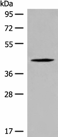QTRT1 Polyclonal Antibody (E-AB-52610)
